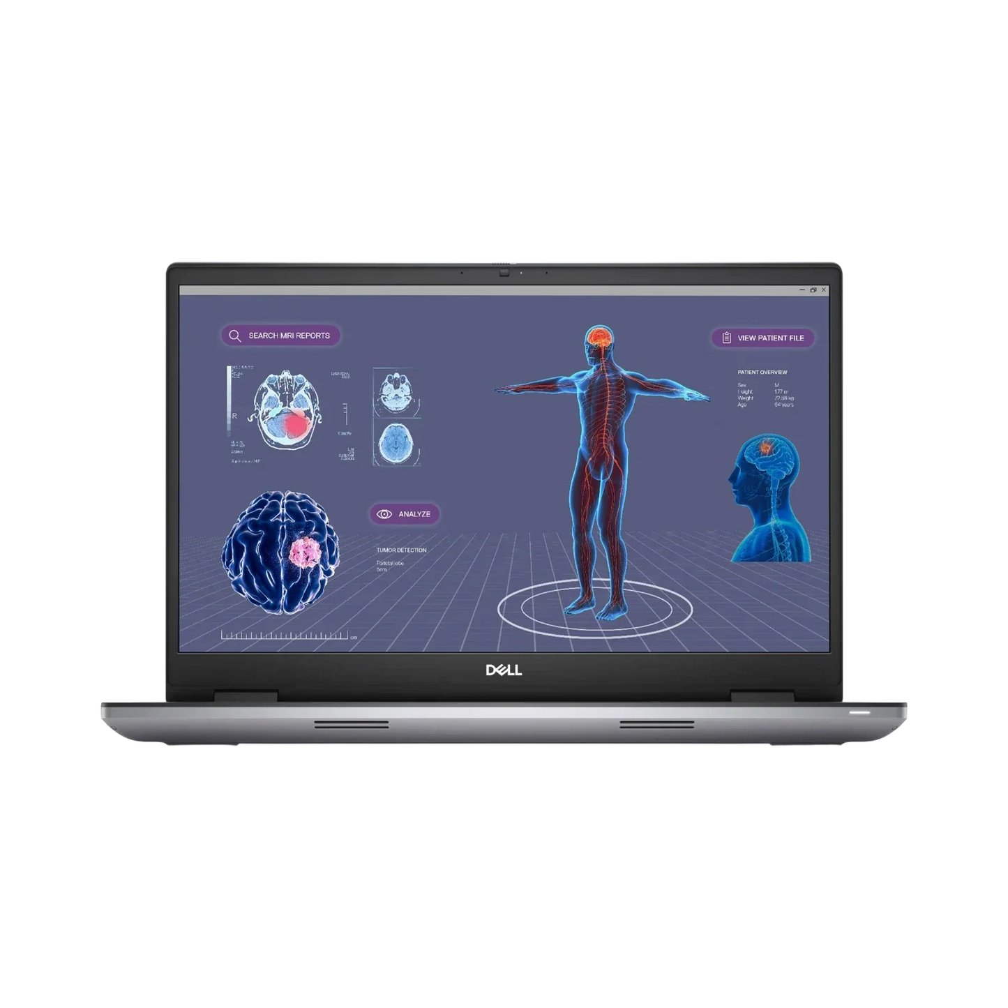 Dell Precision 7780 17.3" Mobile Workstation Intel Core i7-13850HX, NVIDIA RTX 1000, 32GB RAM, 512GB SSD